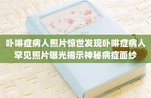 卟啉症病人照片惊世发现卟啉症病人罕见照片曝光揭示神秘病症面纱